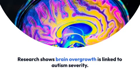 Autism Severity Linked to Brain Overgrowth, Research Shows
