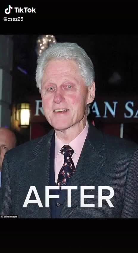 BILL CLINTON - BEFORE AND AFTER