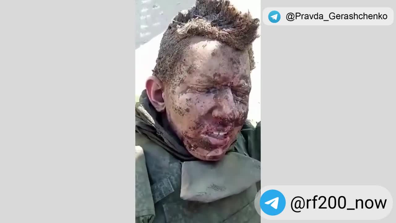 Captured Wounded Russian Soldier