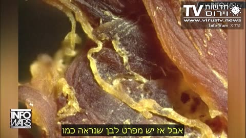 חדשות וירוס TV - מהדורה 511 • מה זה הדבר הזה מה מכילים החיסונים- 2 אזהרת צפייה