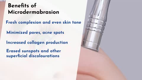 Great Skin Benefits of Microdermabrasion