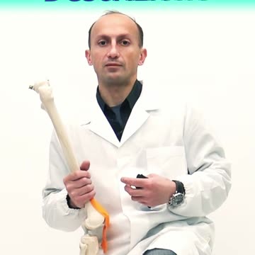 Lesione Meniscale Radiale o a Manico di Secchio