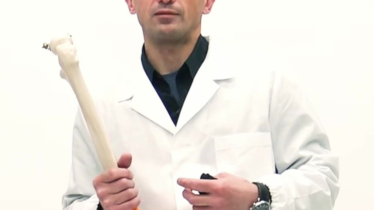 Lesione Meniscale Radiale o a Manico di Secchio