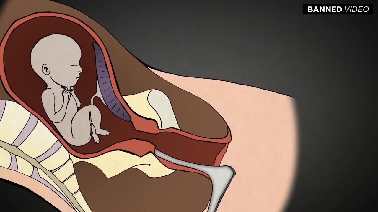 Abortion Procedures: 1st, 2nd, and 3rd Trimesters