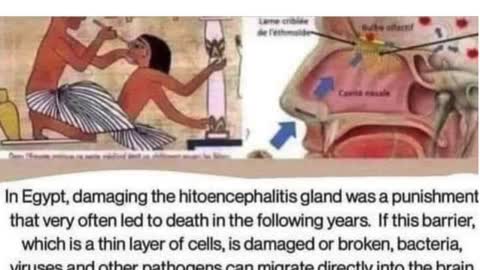 Nasal swab test destroys the hitoencephalitis gland , the protective barrier to the brain.