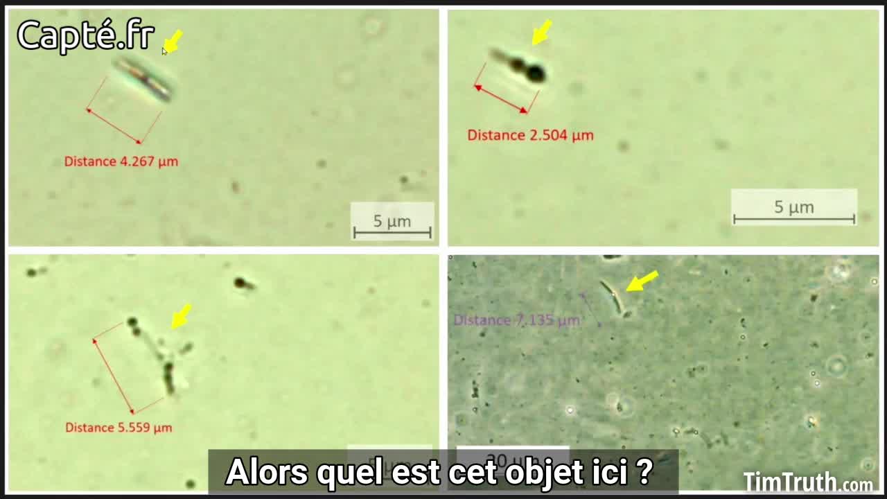 VOSTFR- Moderna sous microscope-De grosses structures suspectes là aussi !!