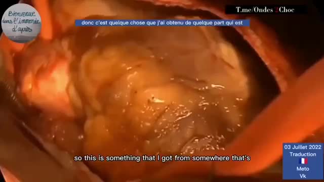 What is being found in vaccinated people