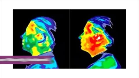 THE DANGERS OF EMF RADIATION ALL AROUND US FROM OUR DAILY DEVICES.