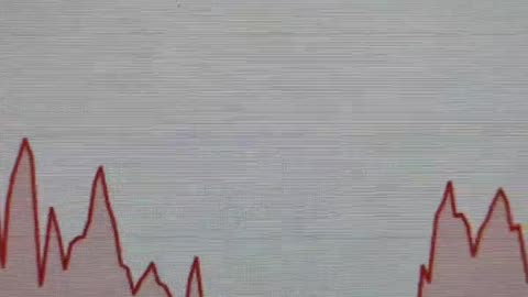 RUN! Memes be ruggin, Benji Miggles Luna Crypto Base Memecoin Charts look terrible