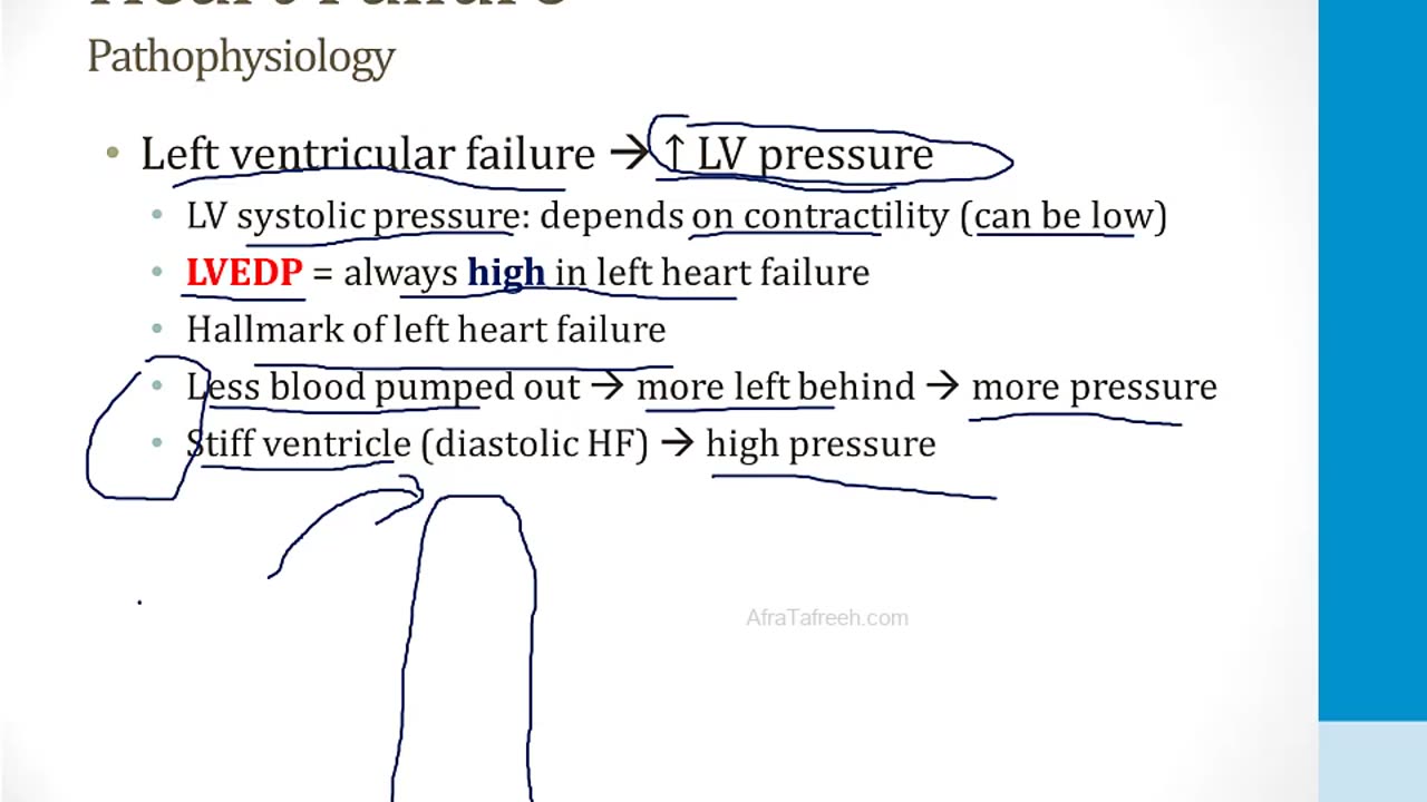 Cardiology - 6. Heart Failure - 1.Heart Failure Basics