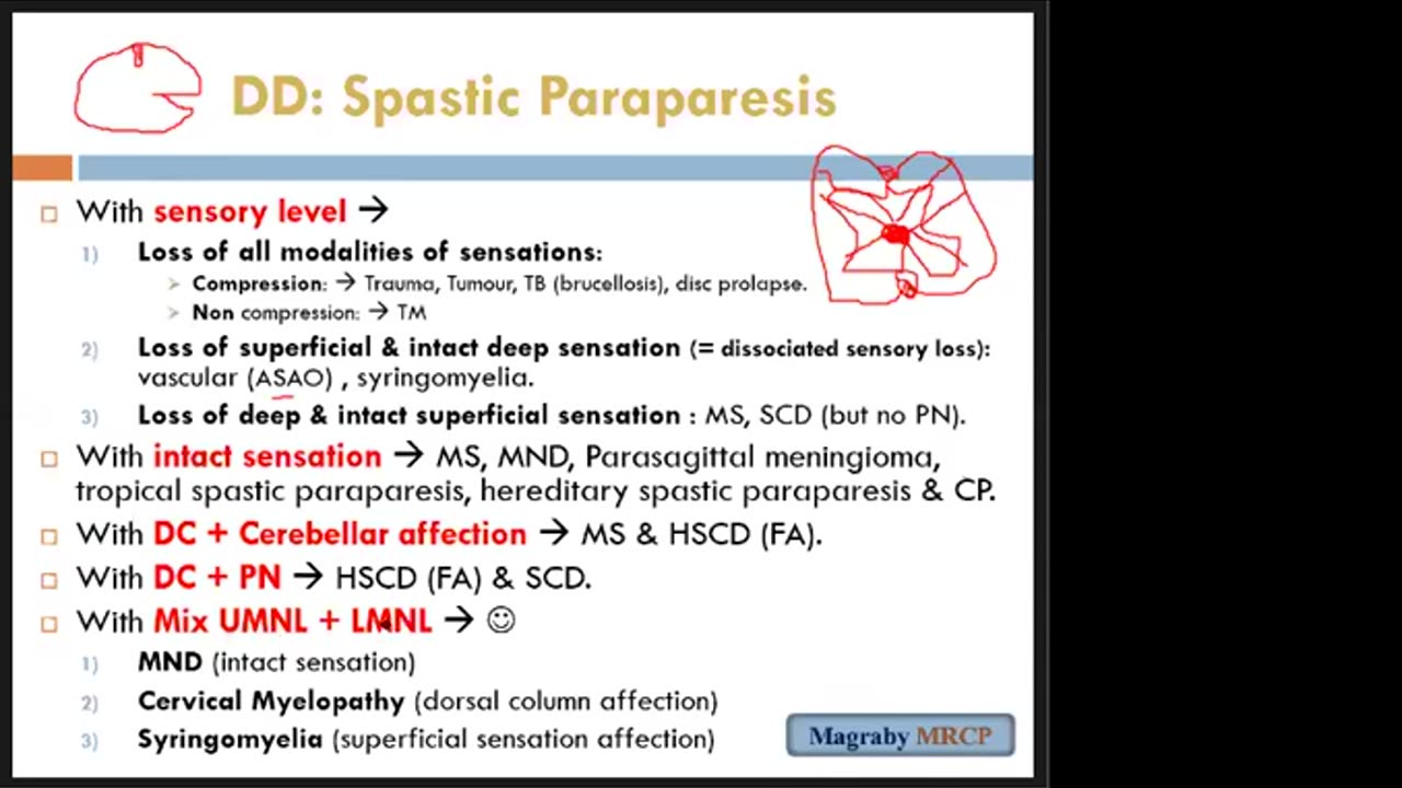 Neurology Examination MRCP PACES (Lecture 5) (Spastic Paraparesis 1)