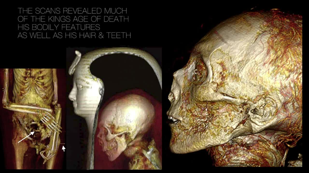 Pharaoh Amenhotep I Facial Reconstruction from Egyptian Mummy