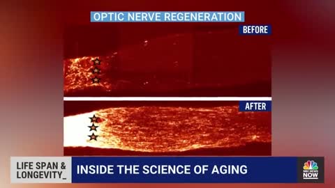 Researchers Say They Are Close To Reversing Aging