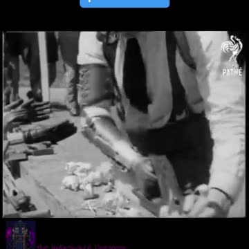 Historic Artificial Limb Technology was pretty Cool