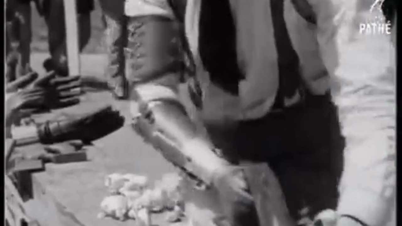 Historic Artificial Limb Technology was pretty Cool