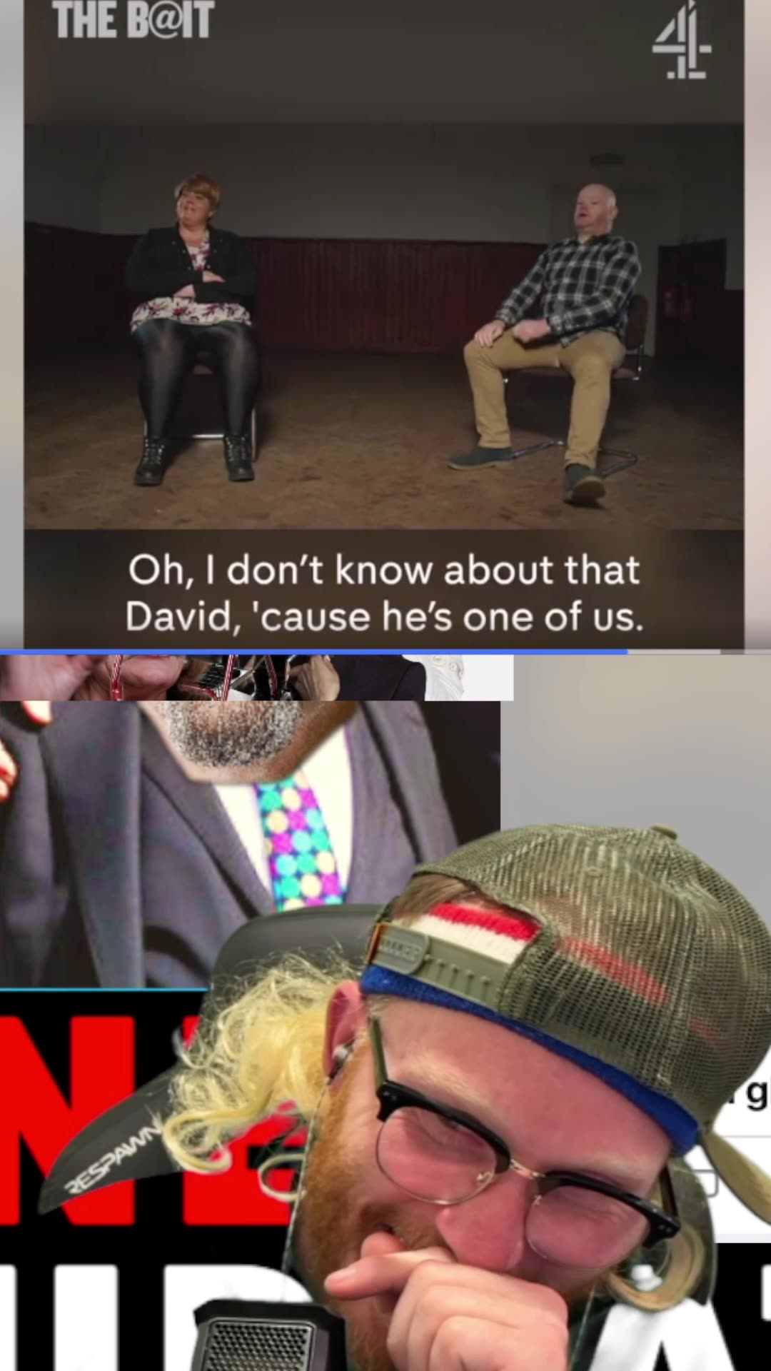 Gingers vs Bald Men #