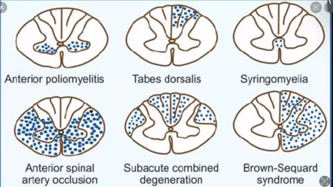 Neuro 2 Ihab Khattaby