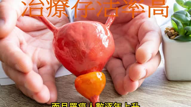 攝護腺癌 治療存活率高