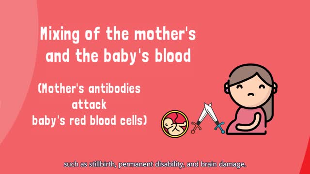 [Quick Guide] How does blood type (Rh) incompatibility affect pregnancies? Part 2