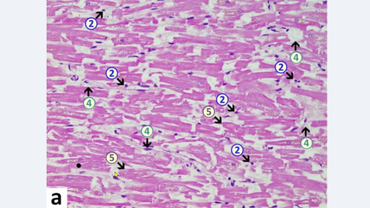 BRAIN & HEART DAMAGE CAUSED BY THE JABS - PEER REVIEWED