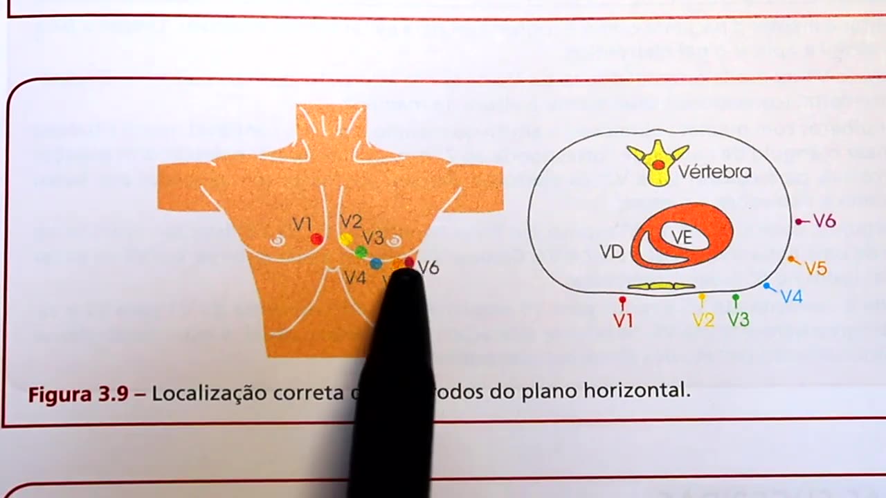 Dicas de ECG: como posicionar o eletrodo no paciente?