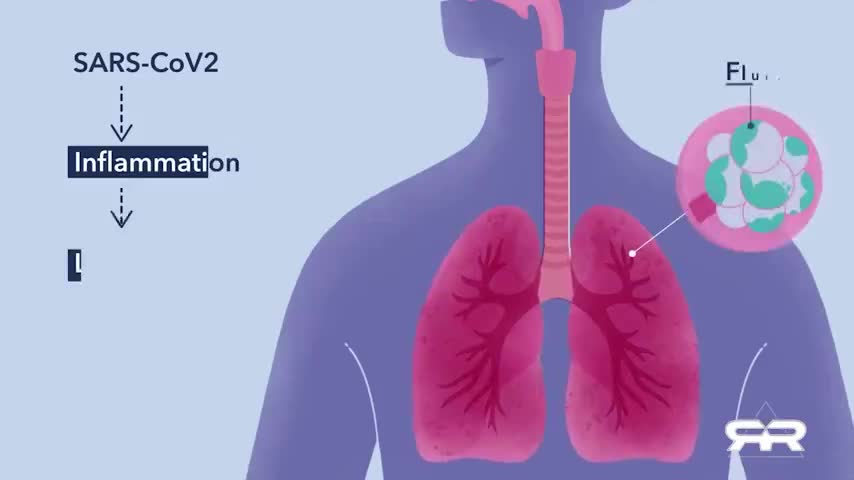 Irrefutable Evidence Proves Deaths by Covid-19 Vaccines