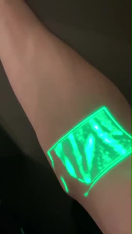 Vein viewers use near-infrared light to map out your veins...