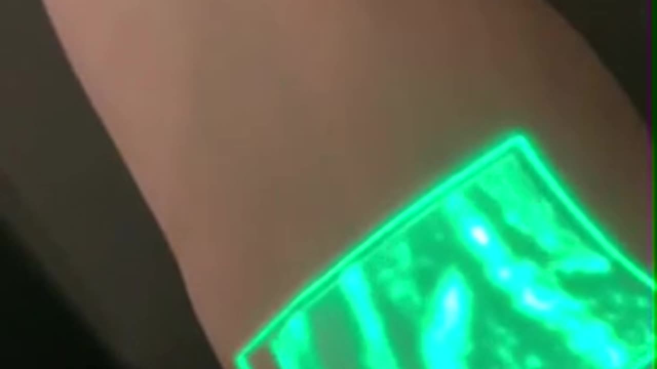 Vein viewers use near-infrared light to map out your veins...