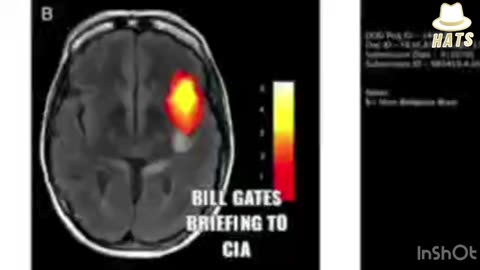 Bill gates is talking about parts of brain and how they can be controlled with drugs and va<<ines