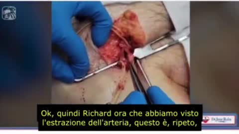 Reazioni avverse al siero genico... orrore 112