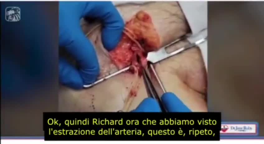 Reazioni avverse al siero genico... orrore 112