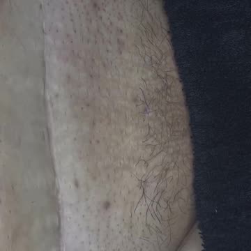 Valentine's Day Ready Bikini Waxing with Sexy Smooth Tickled Pink Hard Wax | Allie's House of Wax