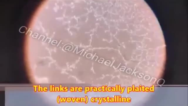 mRNA \/a€€ine under the microscope!
