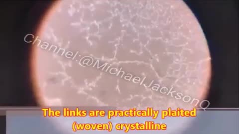 mRNA \/a€€ine under the microscope!