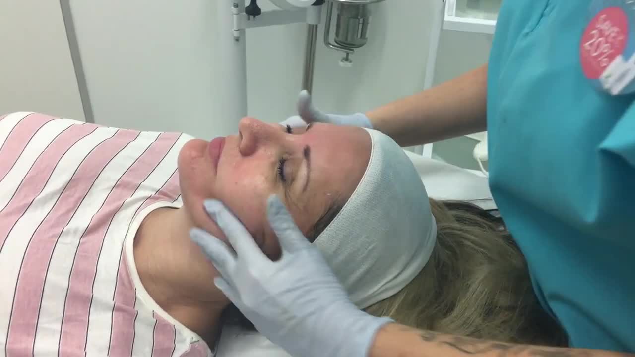 Ageless Peel