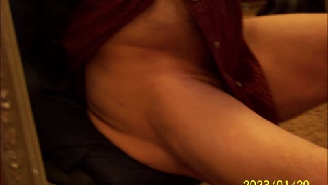 Remarkable Connective Tissue / Fascia damage - Video PICS JAN 20 2023