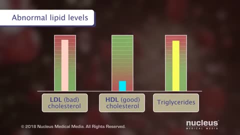 Dangers of high blood sugar!