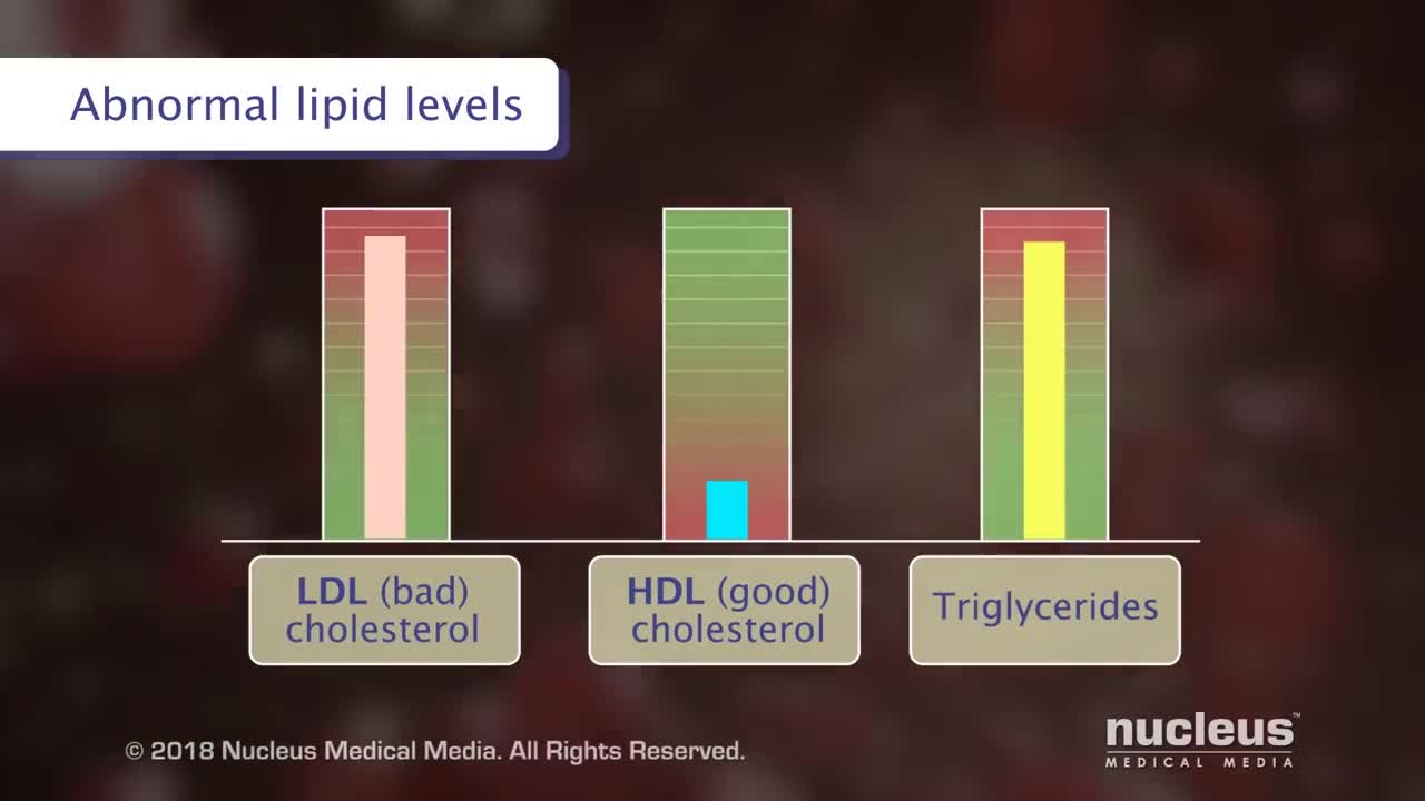 Dangers of high blood sugar!