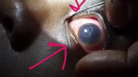 How a Parasite Looks Through a Kid's Eye - SCARY