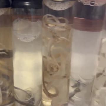 Terrifying Discoveries Inside the Veins of the Deceased