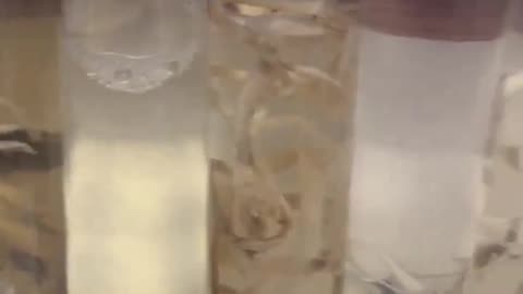 Terrifying Discoveries Inside the Veins of the Deceased