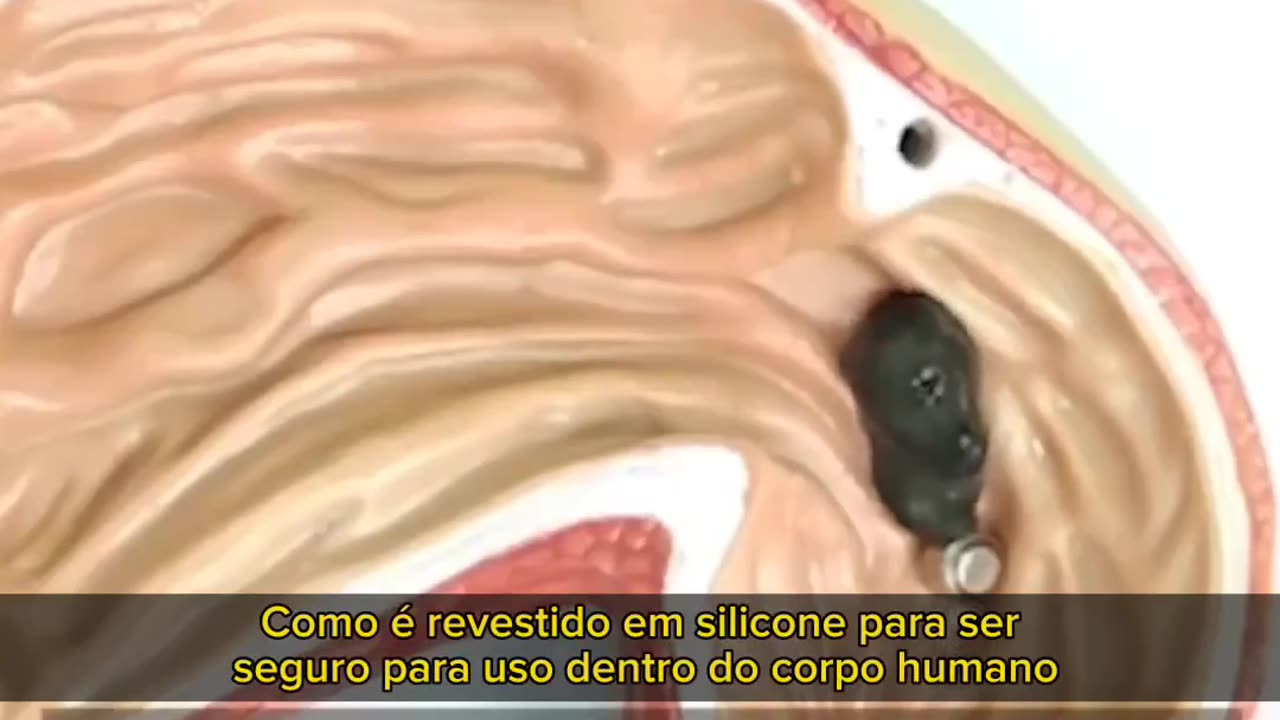 130 - Hidrogel e grafeno sendo usado dentro do corpo?