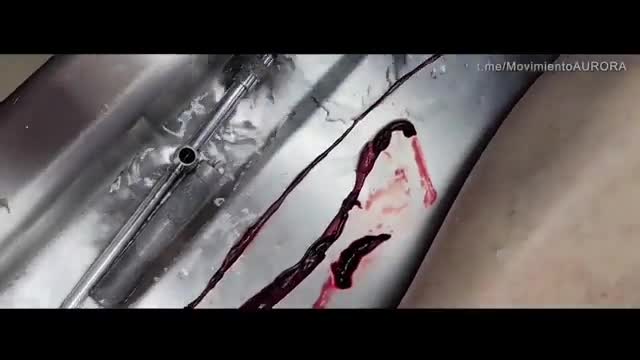 Reportaje sobre Muertes Repentinas tras Inyección