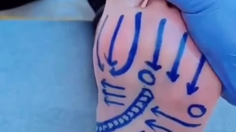 Lifehack Foot Massage