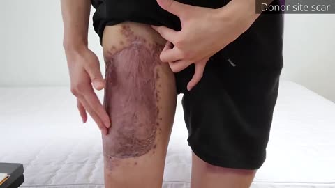 What this girl went through to have a penis made.