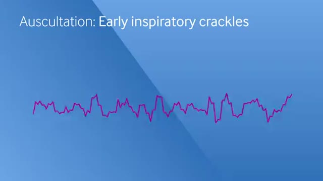 Early inspiratory crackles
