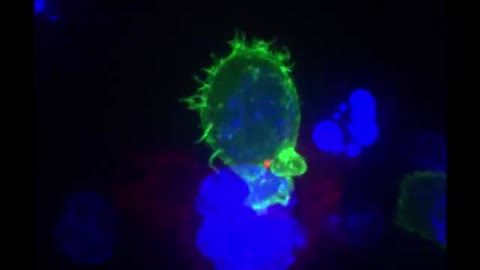 Killer T cell attacking cancer