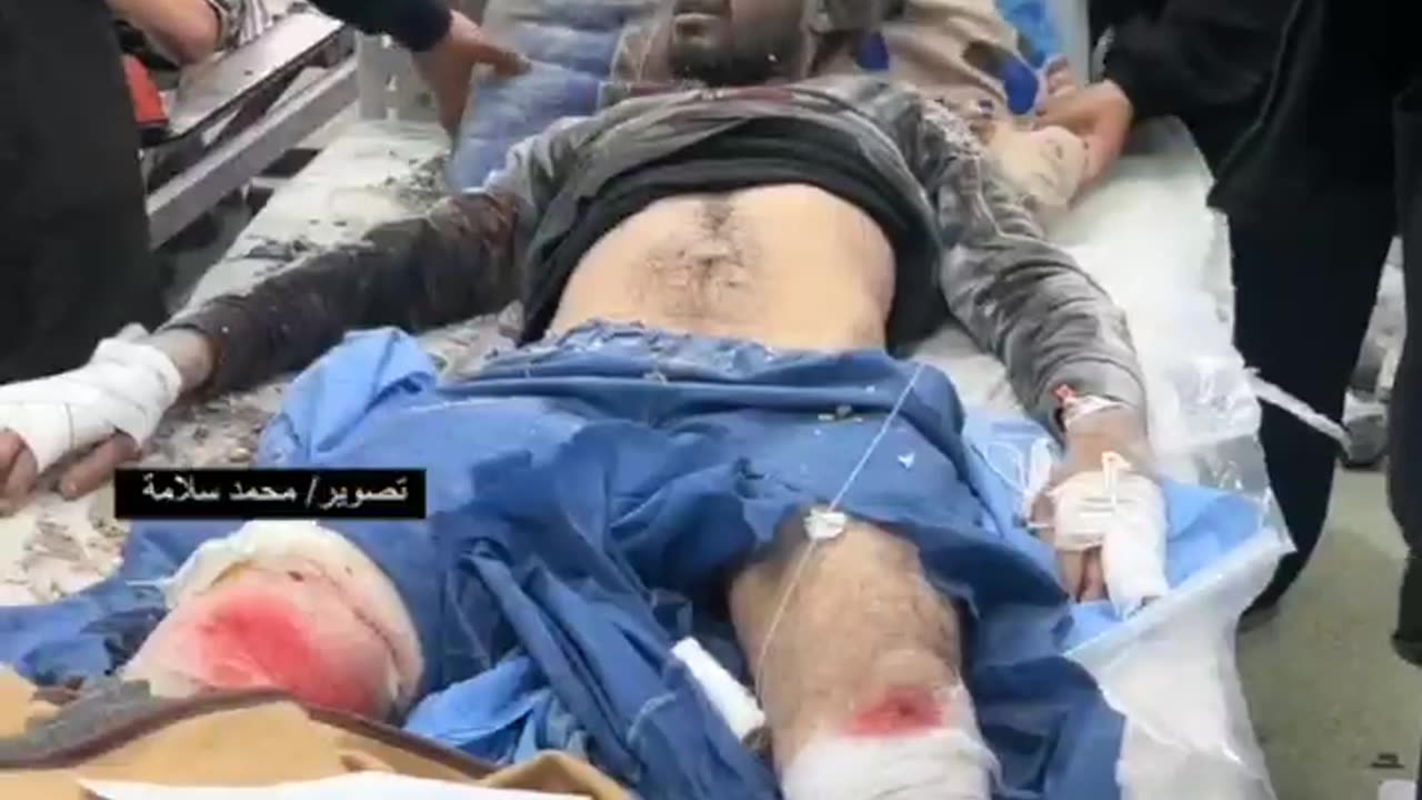 #شاهد | أصابه الاحتلال مرتين.. إصابة أحد الجرحى للمرة الثانية في قصف الاحتلال لمستشفى ناصر بخانيونس.
