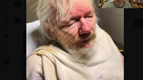 Latest Photo of Assange! Torture and Shame!!!