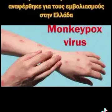 Ευλογιά των Πιθήκων: Δείτε τι αναφέρθηκε για τους εμβολιασμούς στην Ελλάδα